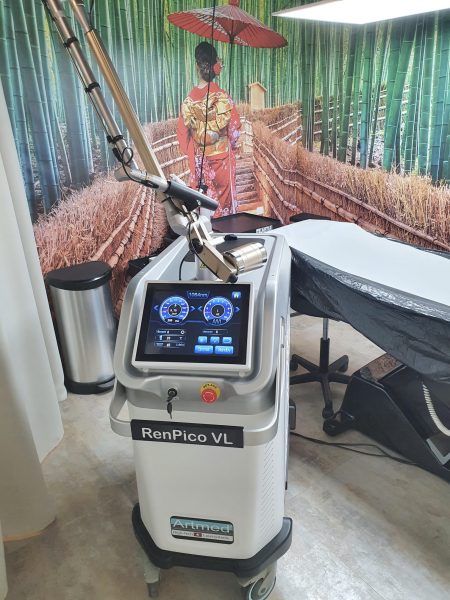 tattoo-removal-bern-lebende-legend